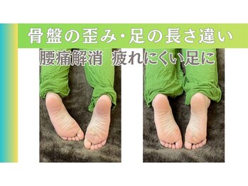整体眞田流/骨盤の歪みによる足の長さ違い