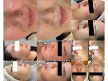 パリスヒロトン(PARIS HIROTON)の雰囲気（機械多数完備！貴方に合う組み合わせで早☆痩身！）