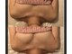ブエナイン(Buenaine)の写真