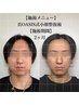 【圧倒的小顔】脂肪分解/骨格改善/整体 150分¥66,000 真OASIS式小顔整復術