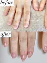 ニコワイズネイル(Nico Y's Nail)/【自爪育成コース】