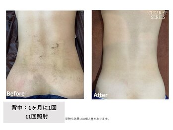 ビープランニング(B-PLANNING.)/【うぶ毛に効果的★】