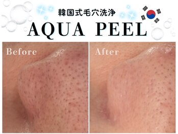 ヘティ バイ ソウル 中目黒(HETIY by Seoul)の写真/《韓国直輸入機器使用》韓国式毛穴洗浄*水光アクアピール☆毛穴に美容液導入◎内側から潤い溢れる水光肌○*