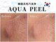 ヘティ バイ ソウル 中目黒(HETIY by Seoul)の写真/《韓国直輸入機器使用》韓国式毛穴洗浄*水光アクアピール☆毛穴に美容液導入◎内側から潤い溢れる水光肌○*