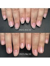 ココ(COCO)/ハンドケア・自爪育成・深爪育成