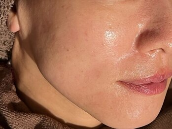 サロン ド エム(salon de m)の写真/うるおい溢れるハリツヤ美肌へ！最先端のエクソソーム導入で、見違えるほどの細胞からの美容体験を。[渋谷]