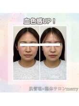 メリー 大和八木店(merry)/血色感UPでスッキリ小顔へ♪