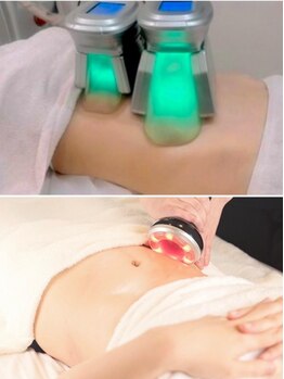 くびれを手に入れたい