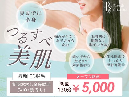 ローズドゥシャロン(Rose de CHALON)の写真