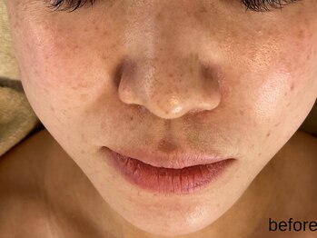 サロン ド エメ(salon de aimer)/【Before】もたつきやすい輪郭も