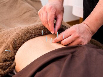 りふぁいん鍼灸整骨院/鍼灸 局所コース(腰部)