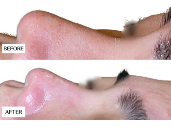 エングラッシー(en glassy)/BEFORE　AFTER　30代