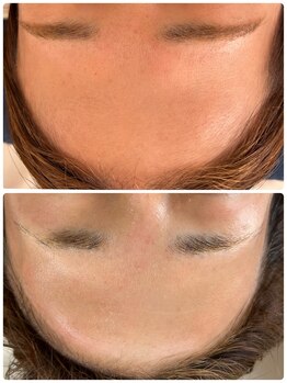 ソレラ(sorelle)/フェイシャルワックス