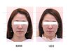 【左右差、お顔の歪みがが気になる方◎】骨格の歪みから整えます！