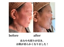 アンベリール(Embellir)