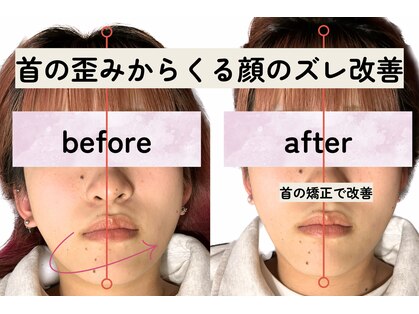 ゼン整体(ZEN)の写真