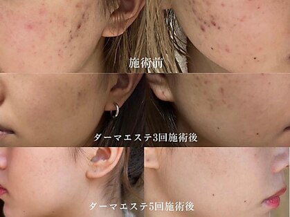 ベネミー 恵比寿(Benemi)の写真