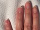 ネイルラボ レモンツリー(Nail Lab LEMON TREE)の写真/今年最後に自分の爪を育てる米国式爪質改善◎50年の歴史を持つ老舗サロンのネイルケアで三ヵ月で縦長の爪へ