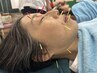 【ハリウッドスタイル上田式美容鍼R】本気の美容鍼20,000円→10,000円