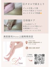 ディオーネ 上越南高田店(Dione)/脱毛手順　2