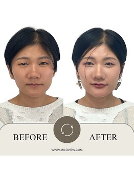 ミラビュー(MILOVIEW)/魅力を引き出すパーソナルメイク