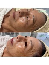 リボーン(be reborn)/初回の方です♪