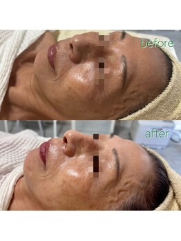 リボーン(be reborn)/初回の方です♪