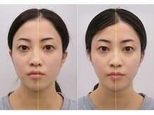 宮崎整体院/【美容整体】全身根本改善コース