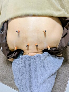 首・肩のつらさを改善したい