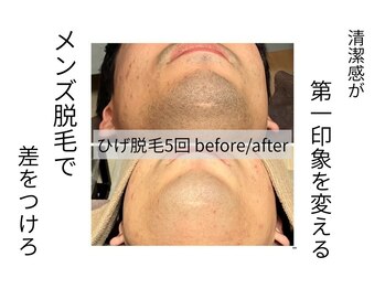 きこりのいずみ