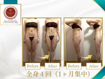 まるる/ハイパーナイフ7痩身★