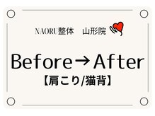 ナオル整体 山形院(NAORU整体)/Before→After
