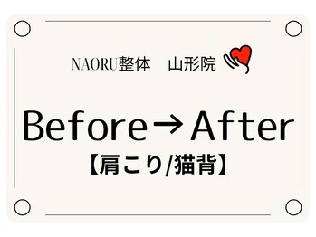 ナオル整体 山形院(NAORU整体)/Before→After