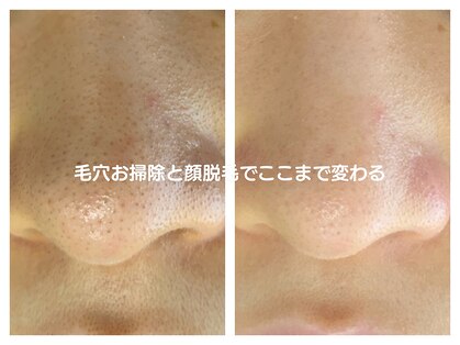 ルミエールブランシュ(Lumiere blanche)の写真