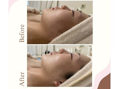 エステ大阪PONの写真