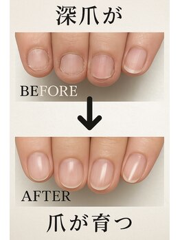 ネイル フライガール(nail FLY GIRL)の写真/爪の悩みを根本からケア！爪を育てる施術とパラジェルコーティングで、憧れの指先へ◎