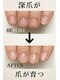 ネイル フライガール(nail FLY GIRL)の写真/爪の悩みを根本からケア！爪を育てる施術とパラジェルコーティングで、憧れの指先へ◎