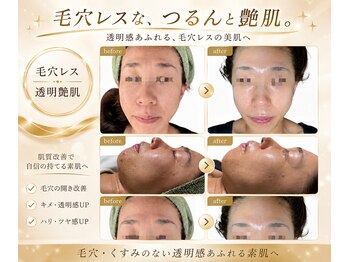 スカイ(sky)の写真/毛穴レスな素肌へ。もうファンデで隠さない。