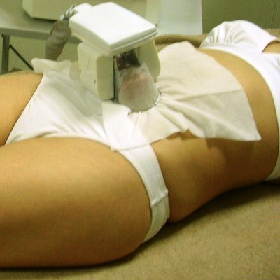 ガッツリ！冷却脂肪集中4箇所