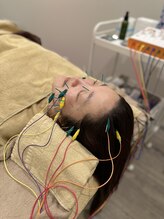 ユララ(YURARA)/YURARAの看板メニュー美容鍼★