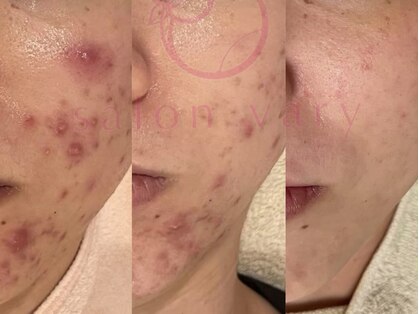 サロンヴェアリー 広尾(salon vary)の写真