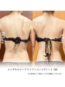 エスプリ 銀座店/銀座痩身・痩せる・ダイエット