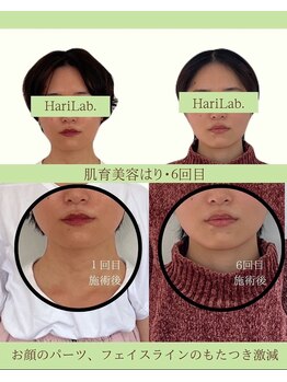 ハリラボ(hari Lab.)/【お客様の声】