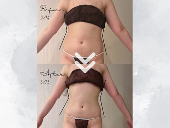 サイバーエステ 宇都宮店/痩せないウエスト、2カ月で…