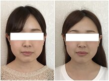 ウェリナ平和堂長久手院/小顔矯正/骨盤矯正/美脚サロン