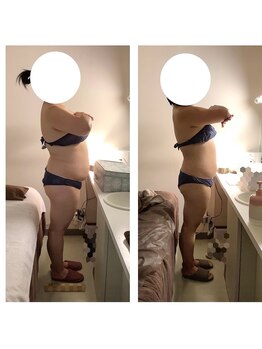 アクア エステティコ 亀有(ACQUA estetico)/痩身　90分上半身　