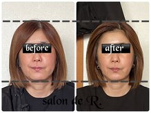 サロン ド アール(salon de R.)/【小顔骨氣・50代・施術効果】