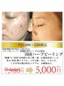 【平日10時～15時限定】剥離＆痛み無ハーブピーリング◎期間限定 ￥5,000