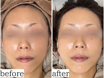 アンドナップ(nap)/スキンケアフェイシャルワックス