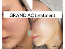 サザンベル 那覇店(Southern Belle)/